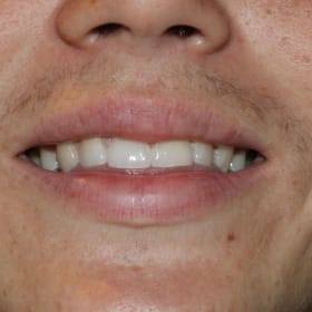 Contestant 19    Audience Choice item