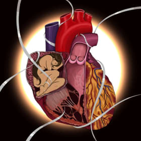 Resting Place (16" x 20" Print) item