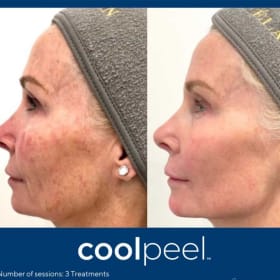 Southern In Aesthetic & Plastic Surgery Laser Facial item