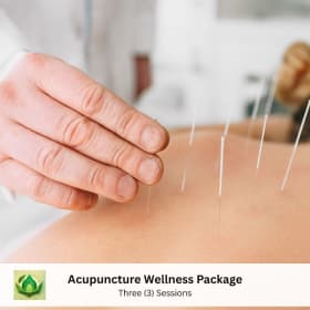 1-18 Acupuncture Wellness Package (3 Sessions) – Valued $310 item
