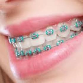 Braces Gift Card item