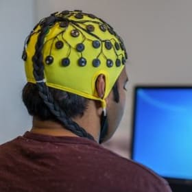QEEG Baseline Measure for Neurofeedback Training item