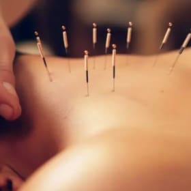 Rapha Acupuncture Treatment- Value $250 (2 of 2) item