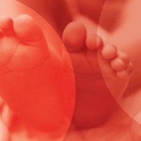 General admission item