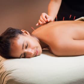 60-Minute Acupuncture Session at Oakville Wellness Clinic item