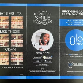 Westwood Dental Glow Bleaching Treatment item