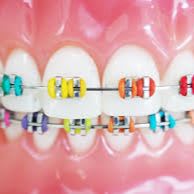 $1500 OFF a SET of BRACES - Dr. Hemphill! item