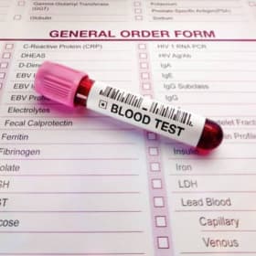 Item #15: Comprehensive Blood Screening Panel item