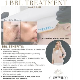 1 BBL Treatment donated by Glow Wilco item