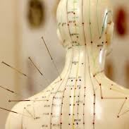 Acupuncture Session item