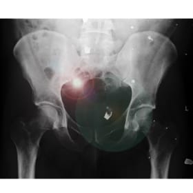 We live for tomorrow Arse item