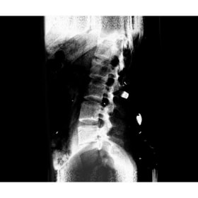 We live for tomorrow Back item