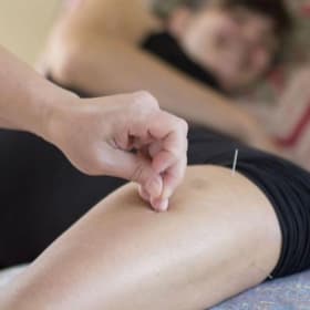 Acupuncture Evaluation & Treatment Session item