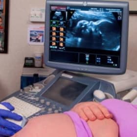 3D Fetal Ultrasound item