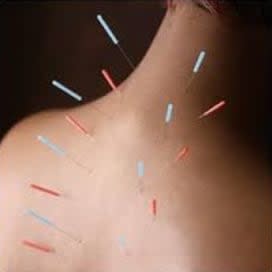 $130 gift card for Hidden River Accupuncture item