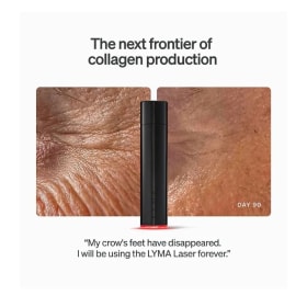 Lyma Laser Starter Kit item