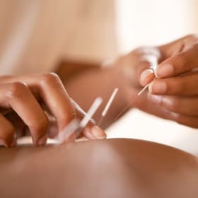 Wellbridge Acupuncture Treatment (Valued at $85) item