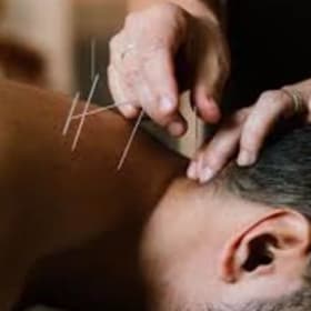 Open Space Acupuncture item