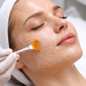 One Chemical Peel from Intentional Wellness MedSpa item