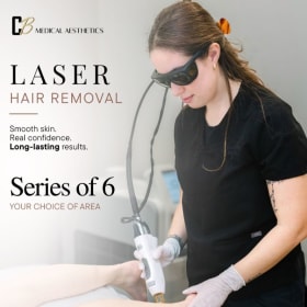 Laser Hair Removal Series of 6 item