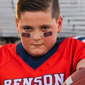 Eye Black Stickers item