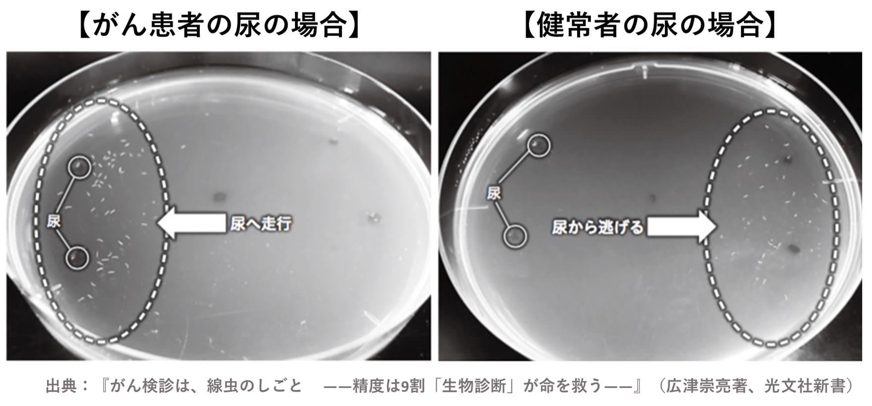 がん検査の常識”が2020年に大きく変わる！ 線虫がん検査「N-NOSE