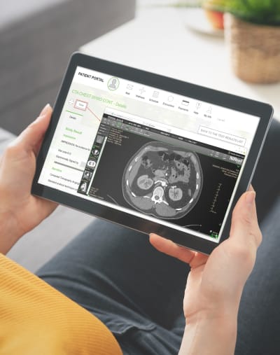 Person holds a digital tablet that displays abdominal imaging via a patient portal. 