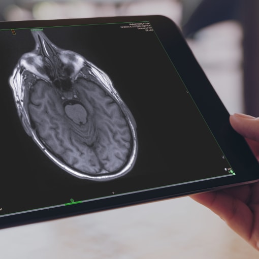 Close-up of a tablet screen with medical imagery on it.