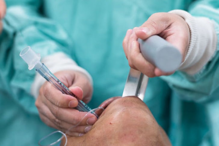 Endotracheal-Intubation.jpg