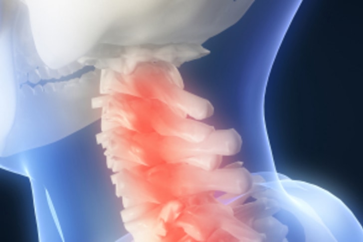 neck-injury.png