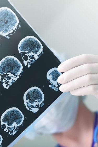 Brain Injury from a Fall or Accident Causing Personal Injury