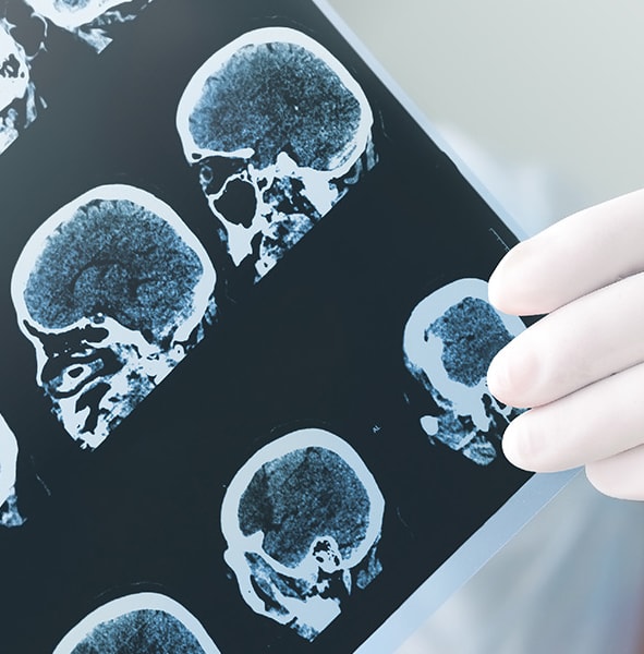 brain-injury.jpg