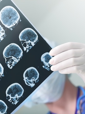Nurse reviewing CT scans of the head
