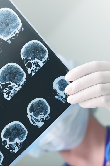 Celebrate Brain Injury Awareness Month by Learning About Brain Injuries