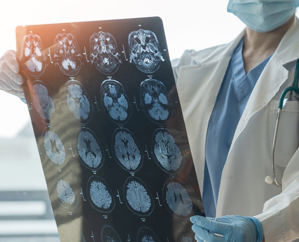 Brain Injury Awareness Month: March ‘23
