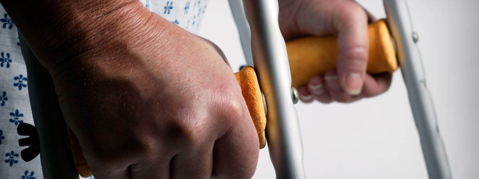 The Mistakes That Lead to a Wrong Amputation