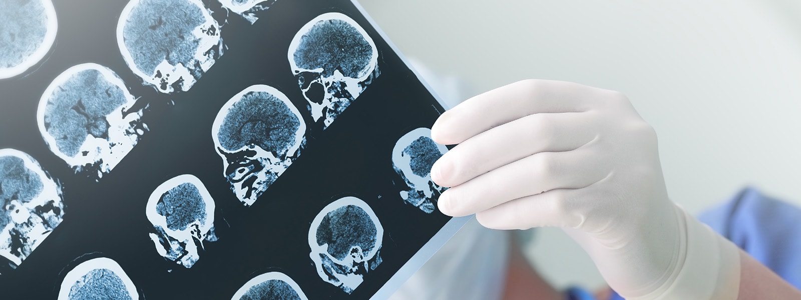 brain-injury.jpg