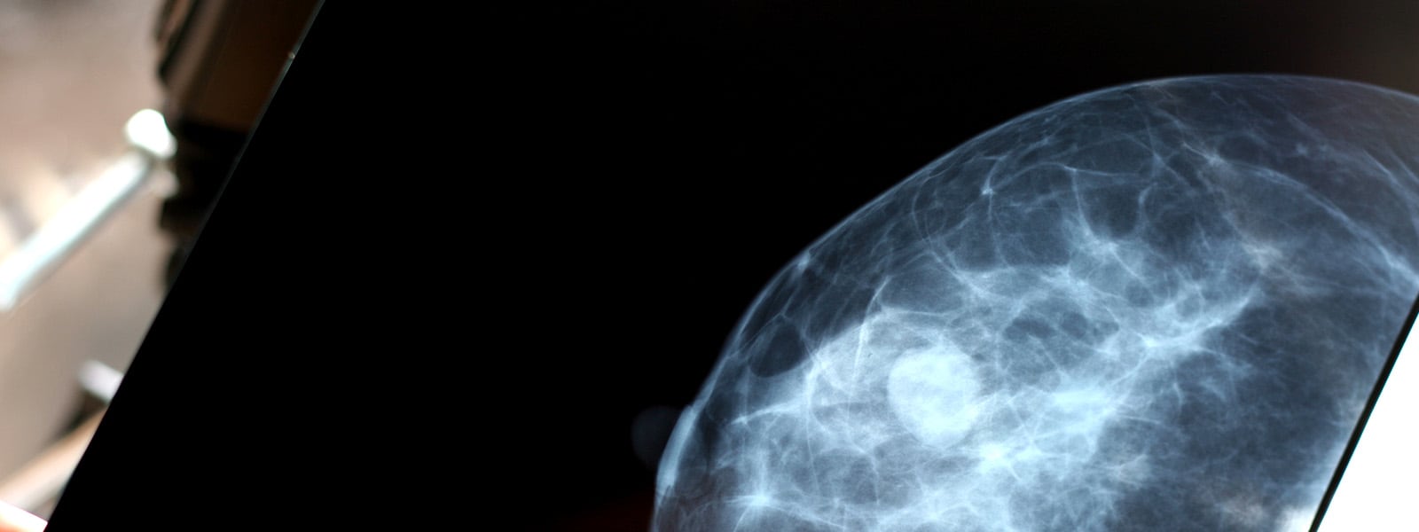 mammogram.jpg