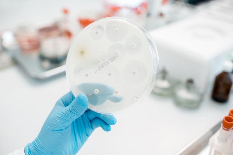 A person with medical gloves holding a petri dish