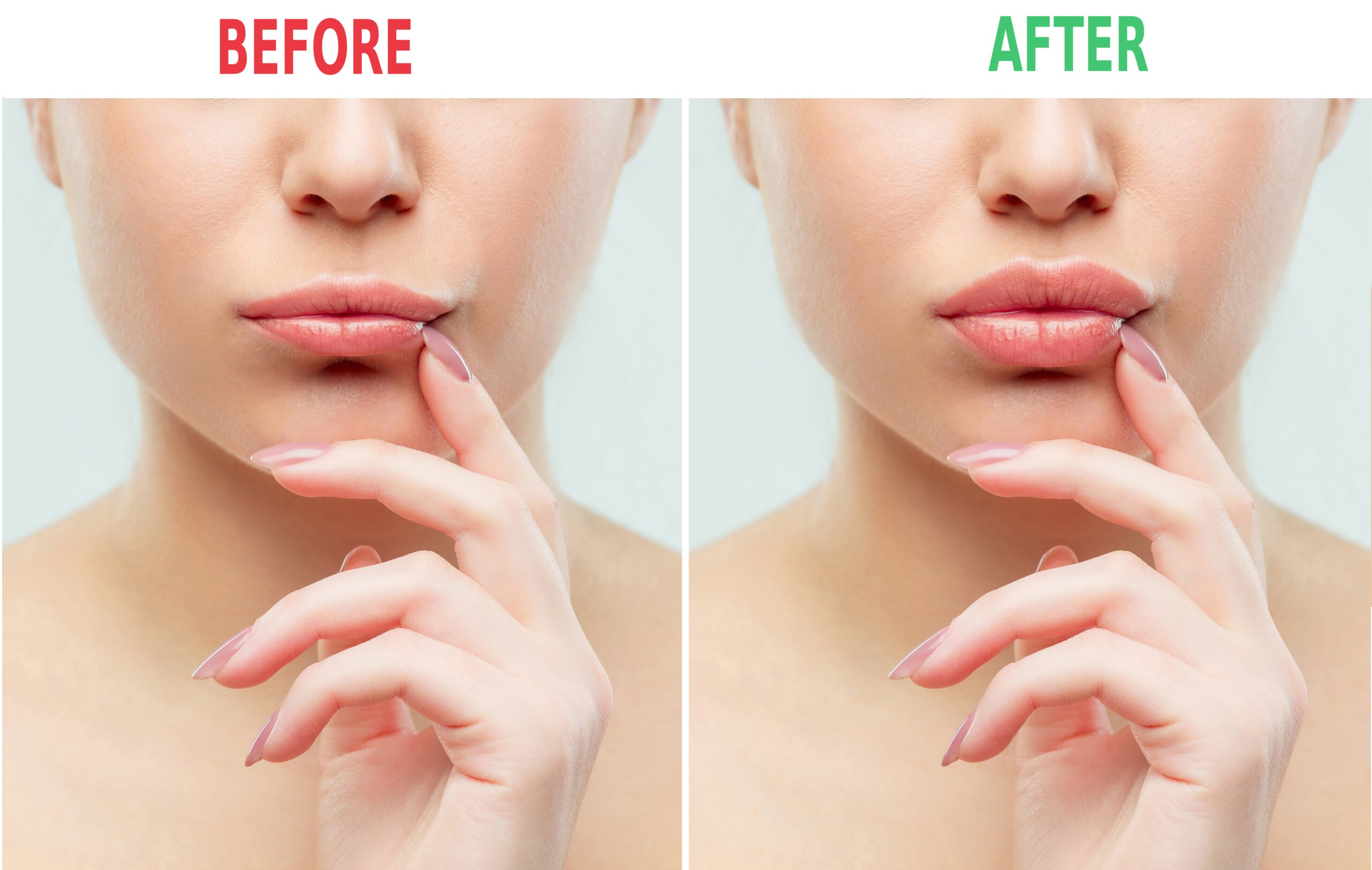 Lip Flip Memphis: Embracing the Subtle Art of Lip Enhancement
