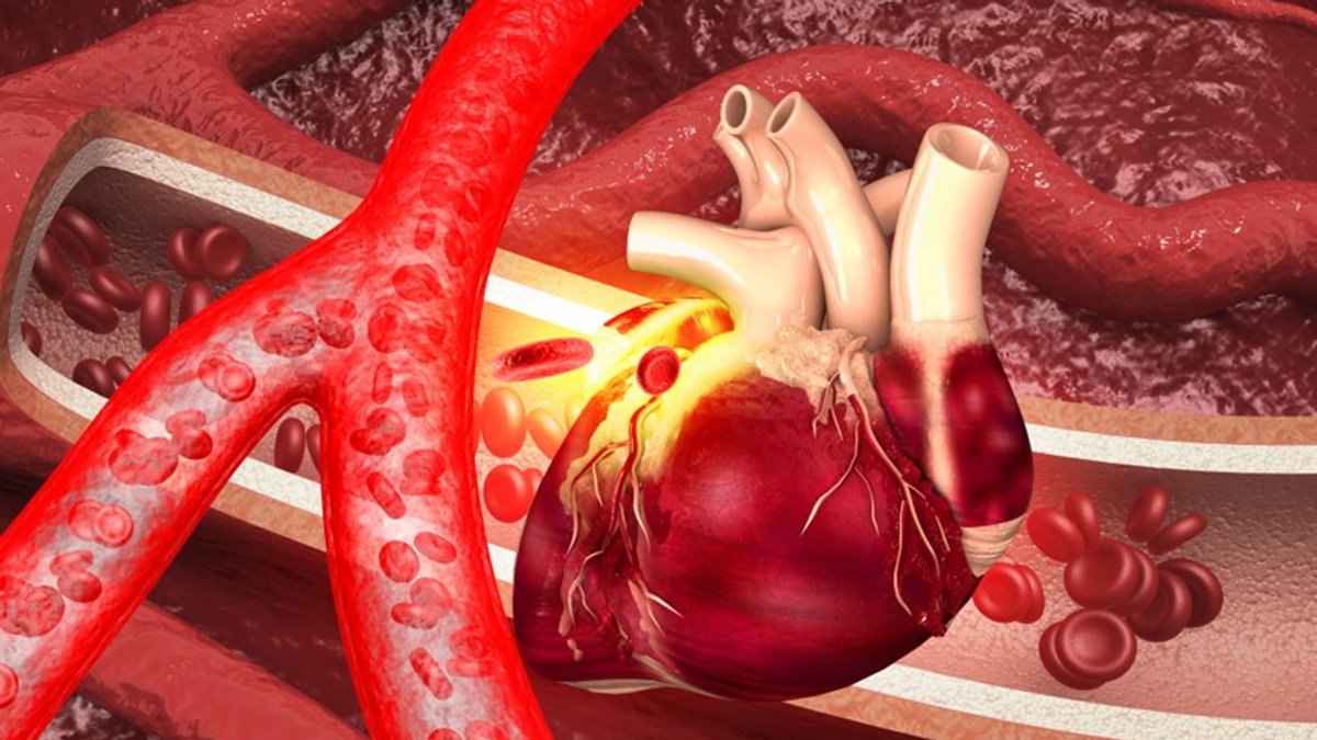 Isomab Shows Safe Blood Vessel Growth in CAD - pro angiogenic therapy