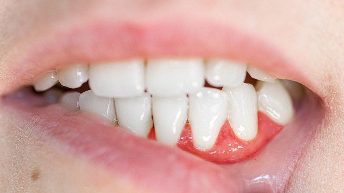 How oral health affects your whole body - oral health