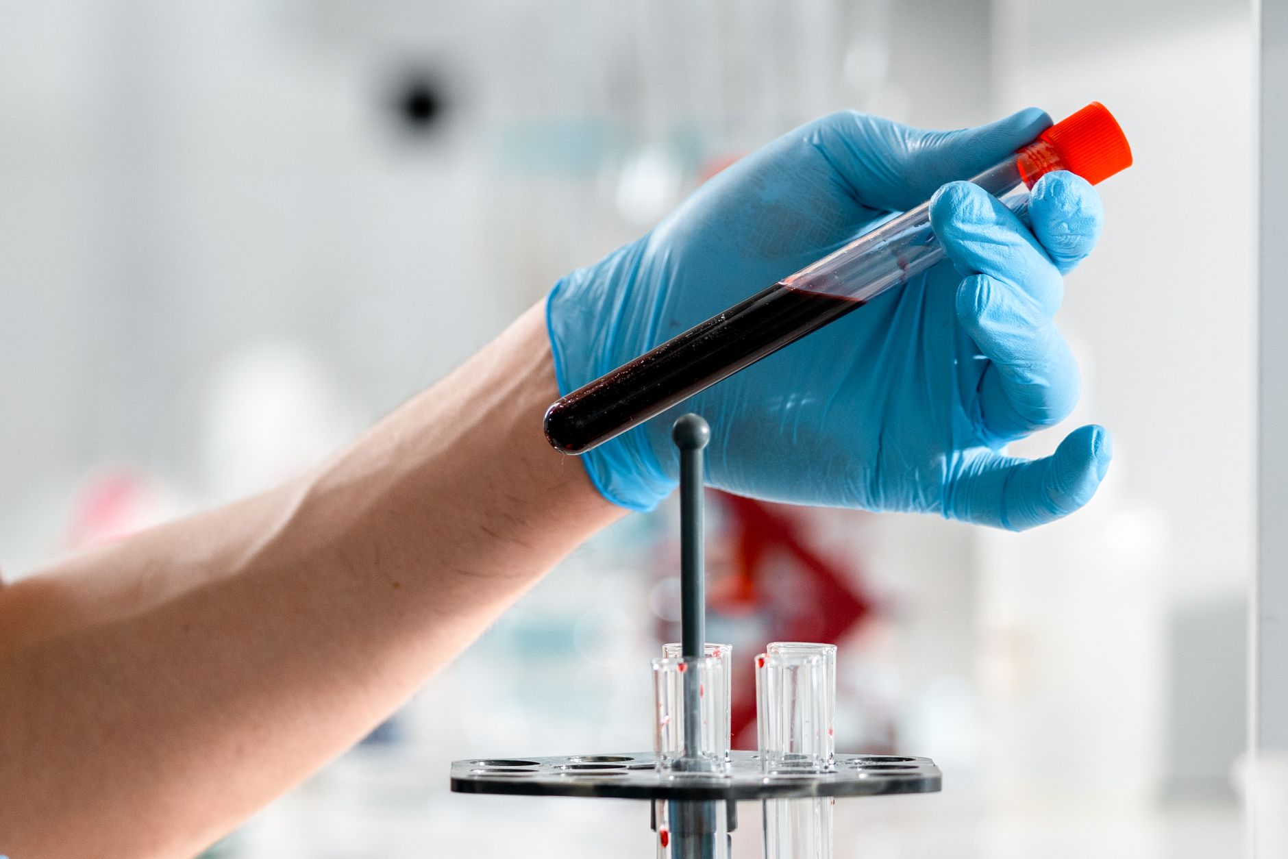 Blood test matches tissue in tough breast cancer cases