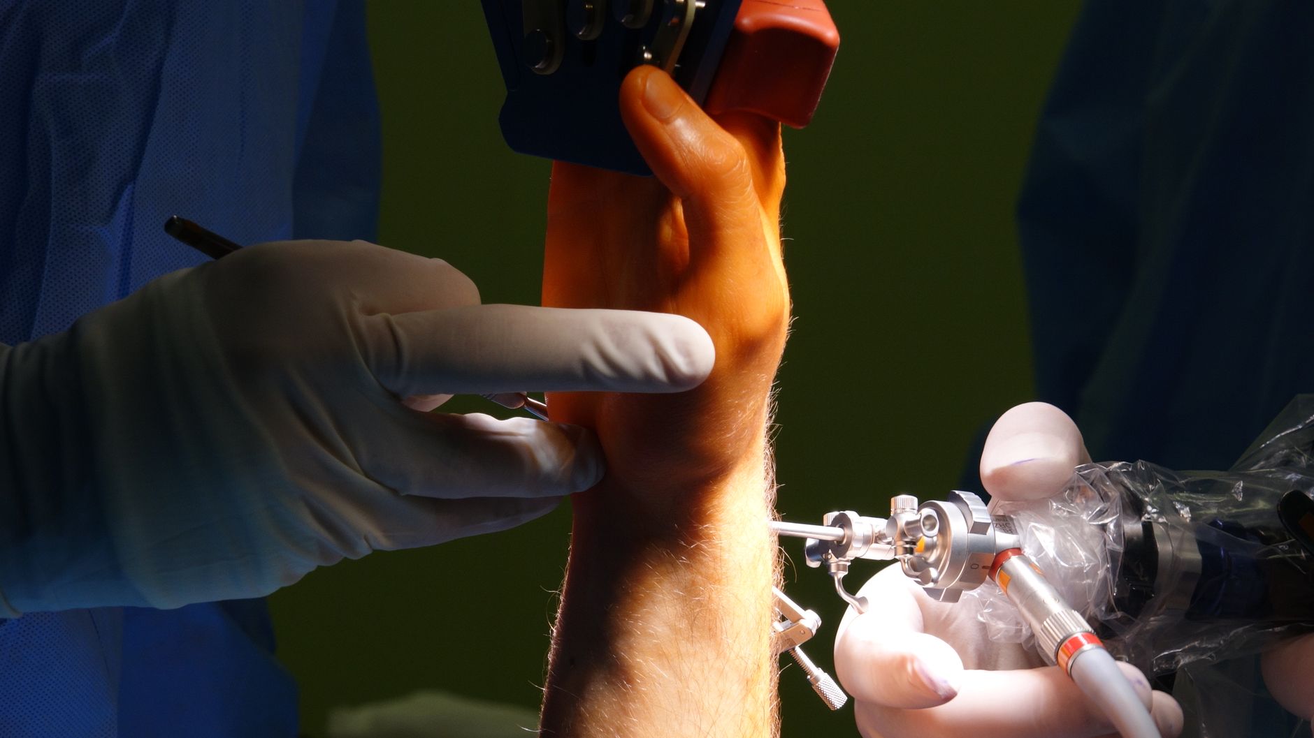 Orthopedic Surgeons And Sports Injuries