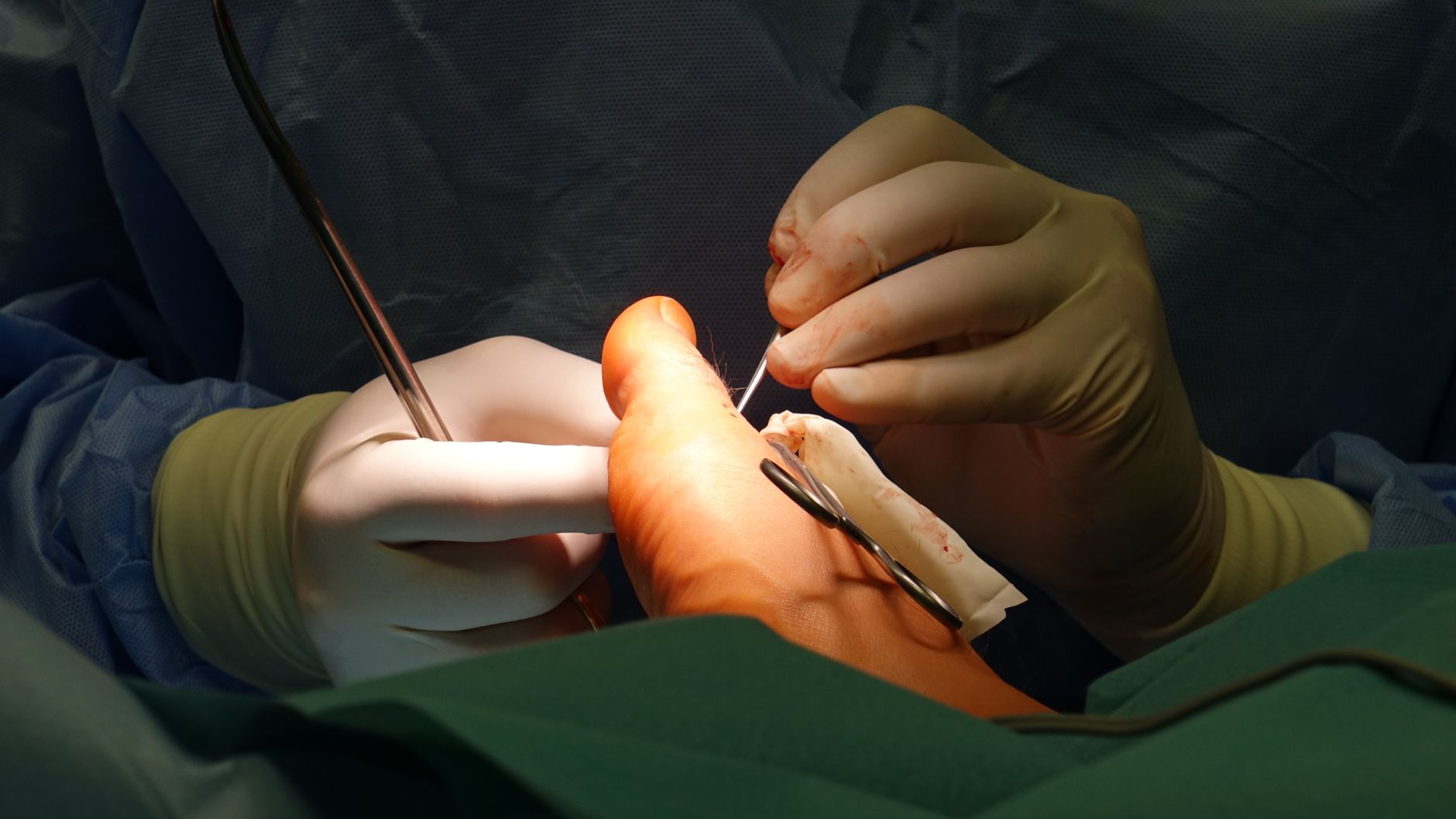 Advancements in Orthopedic Surgery: Latest Techniques and Technologies