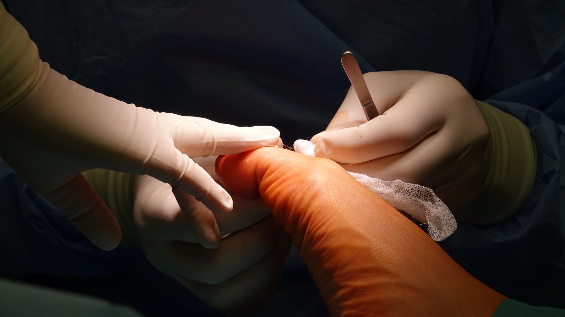 Understanding The Difference: Podiatrist Vs Orthopedic Surgeon