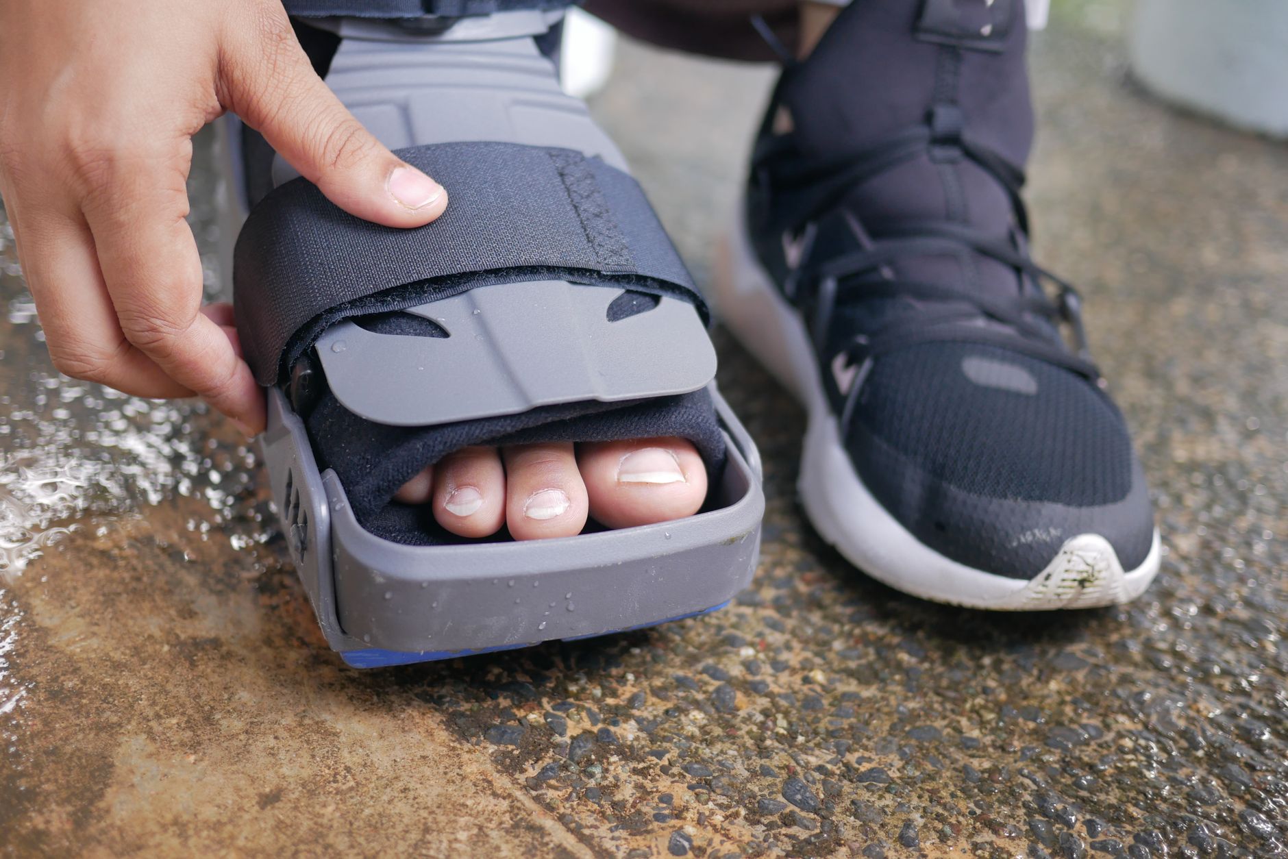 Addressing Frequently Asked Questions About Orthopedic Surgery