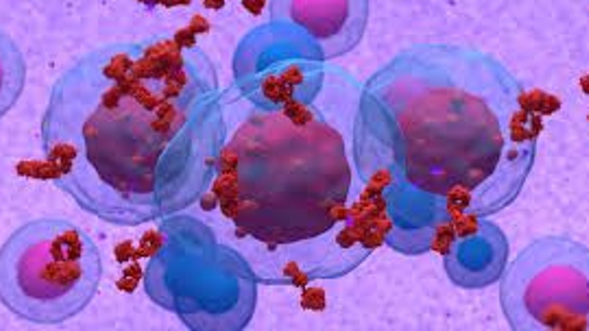 Bristol Myers Squibb Sees Success With CAR T Therapy - car t therapy
