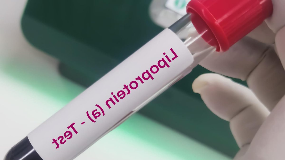 Cholesterol drug research hits major setback Cholesterol drug research hits major setback - cholesterol drug