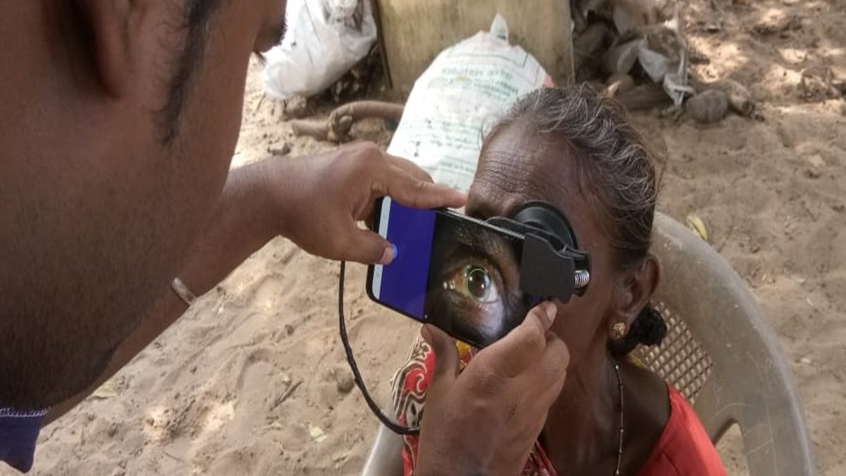 Smartphone tool boosts cataract screening in remote India - smartphone cataract screening